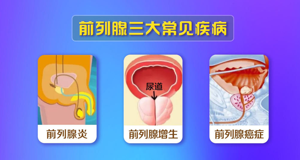 武汉宏昇中医医院：男性不育是由什么疾病导致的？