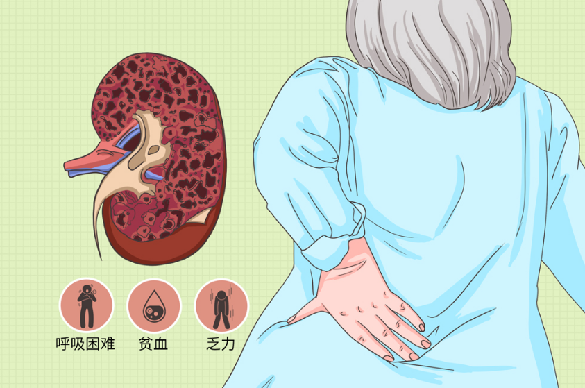 武汉胡靖中医诊所：尿毒症的人越来越多，4种食物尽量少吃！减轻肾脏负担