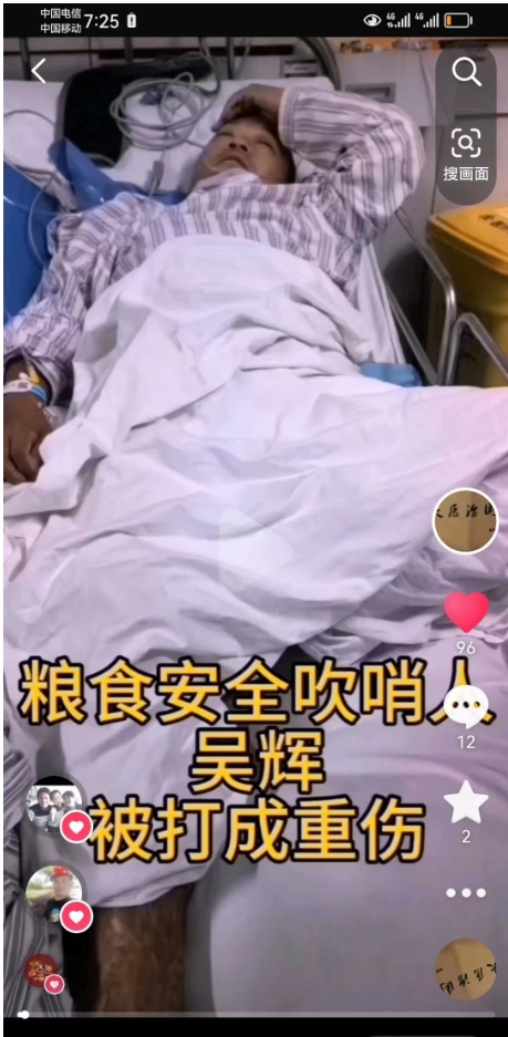 “中国粮食安全吹哨人”吴辉，被打成重伤！他是为了天下苍生受伤的……