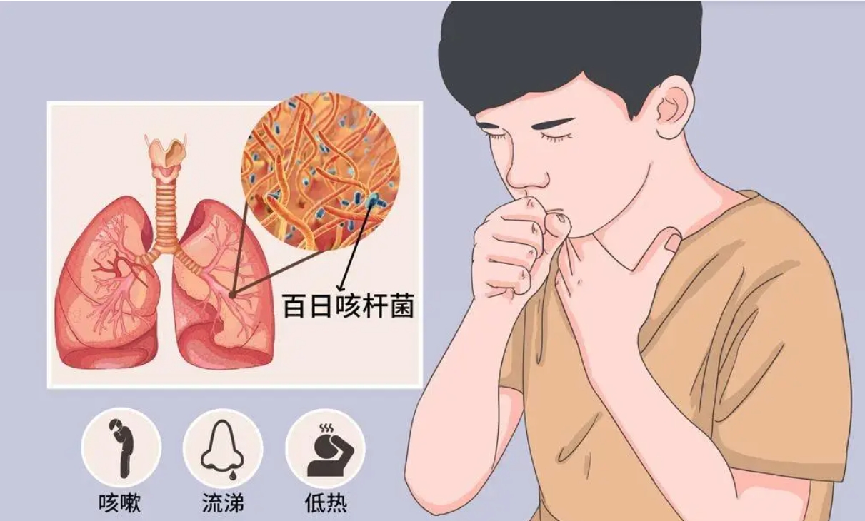 咳嗽痰多时，要先祛痰，介绍5种常用化痰、祛痰药
